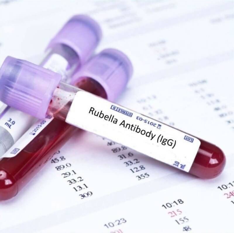 rubella-igg