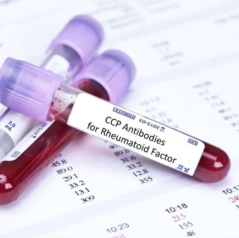 What Is the Anti-Cyclic Citrullinated Peptides (Anti-CCP) Blood Test?