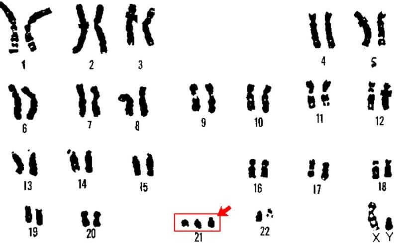 QF PCR là gì và được sử dụng trong điều trị bệnh gì?
