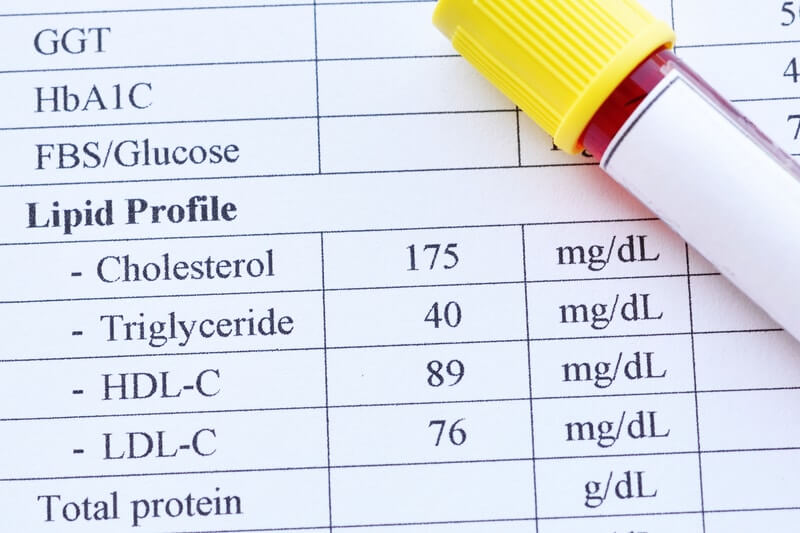 Lipid Blood Tests And Its Index Meaning