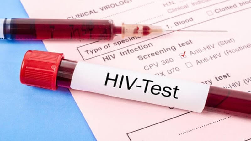 Một số biểu hiện khác có thể xuất hiện sau 4 tháng nhiễm HIV kèm theo các triệu chứng chính?