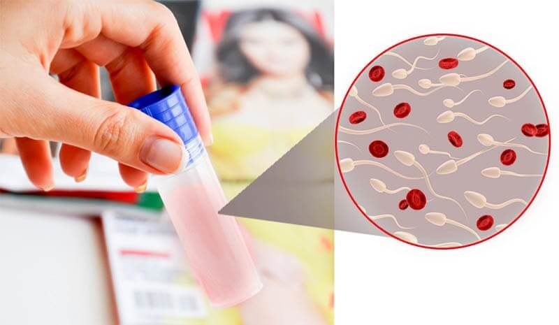 Hematospermia or Bloody Semen - dixe - cosmetics