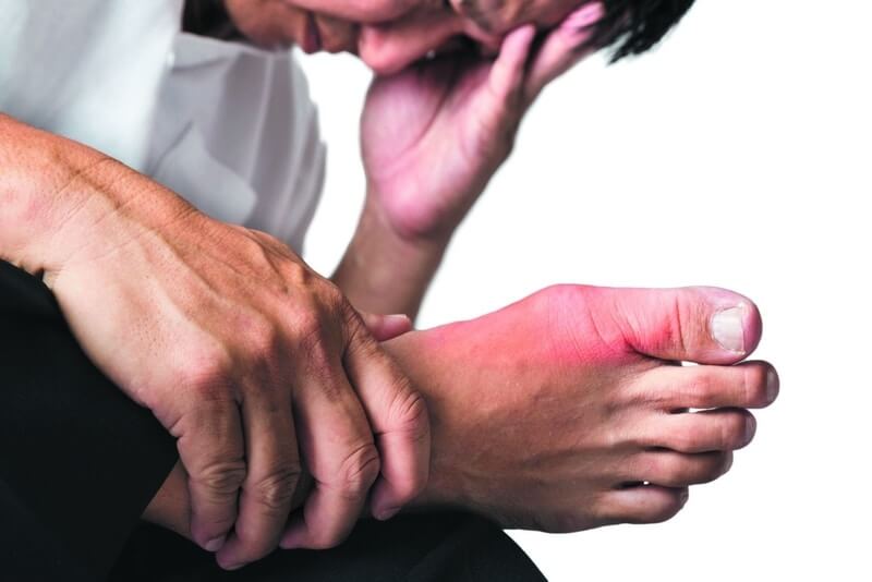 Phương pháp kiểm tra bệnh gout đơn giản kiểm tra bệnh gout 