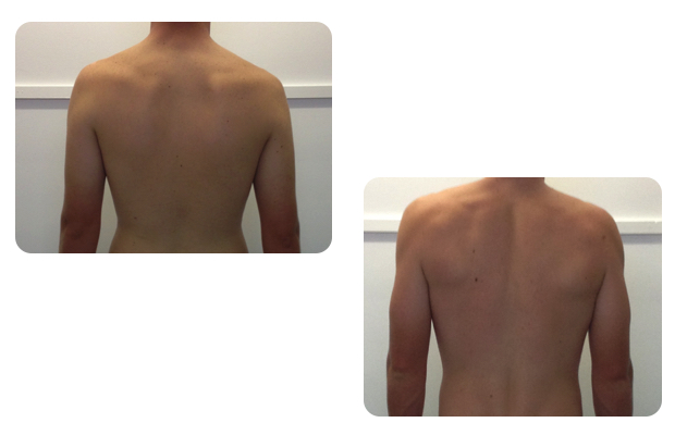 Scap Article Comparison - behind