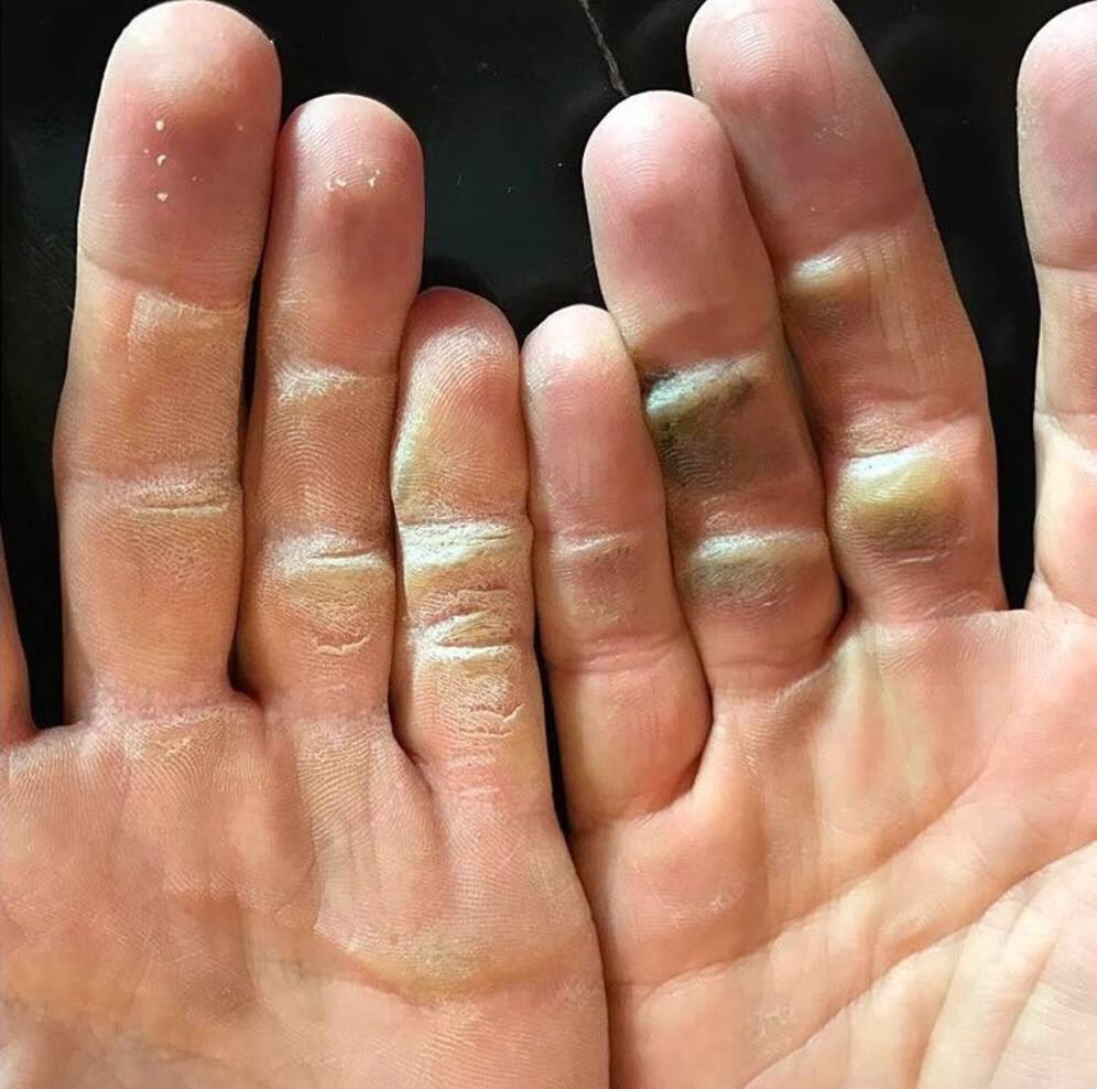 A photo of Alex Noren's hands after a practice session.
