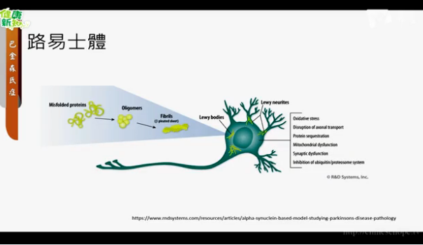 535. 巴金森氏症