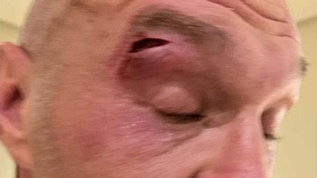 <p>Undisputed Heavyweight Champion Tyson Fury sustains a cut during sparring, forcing the fight to be rescheduled. X/QUEENSBERRY PROMOTIONS.</p>