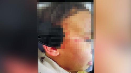 3歲囡仔送奶母照顧煞全全傷 若像予人虐待
