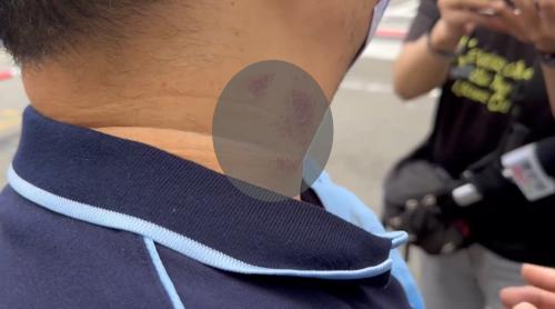 男性暗時走標 頷頸煞予鉛線割著.緊急送病院