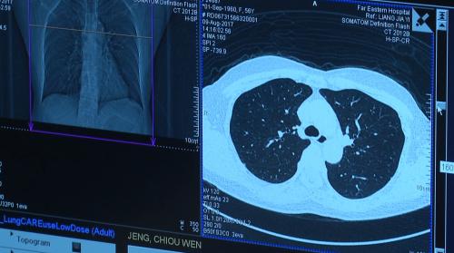 肺癌上濟人超過大腸癌 平均4分19秒就1人著癌