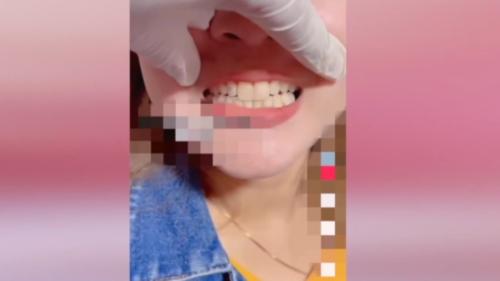 移工看影片學醫美、做喙齒 違法替仝鄉治療