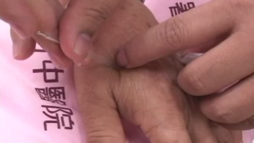 有望開放中醫使用超音波 62名醫師完成訓練