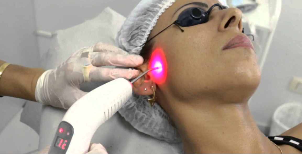 Laserterapia DTM especialidades odontológicas