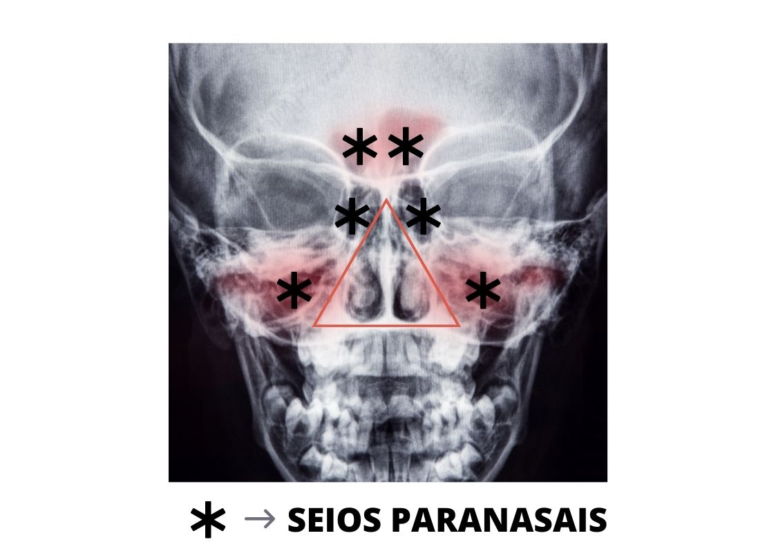SEIOS-PARANASAIS-Imagem.jpg