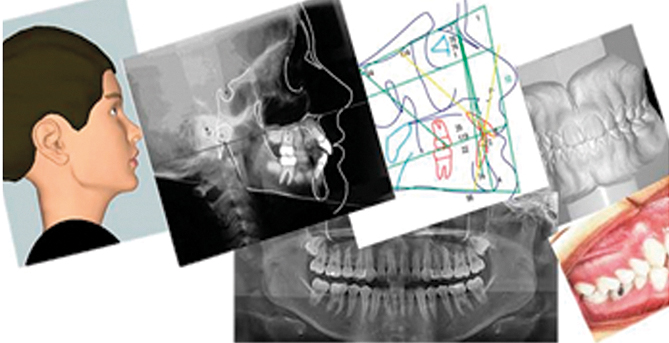 1 pçs dental baixo maxilar mandíbula tecido mandíbula anatômico