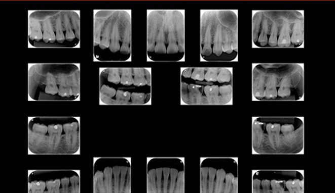 1 pçs dental baixo maxilar mandíbula tecido mandíbula anatômico