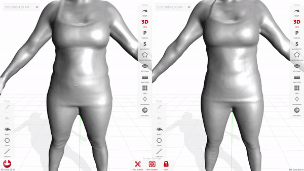3D Body Scanners vs. Body Fat Calipers Which is Better