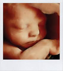 How to Preserve Your Adorable Ultrasound Pictures  Ultrasound pictures,  Ultrasound, Sonogram pictures