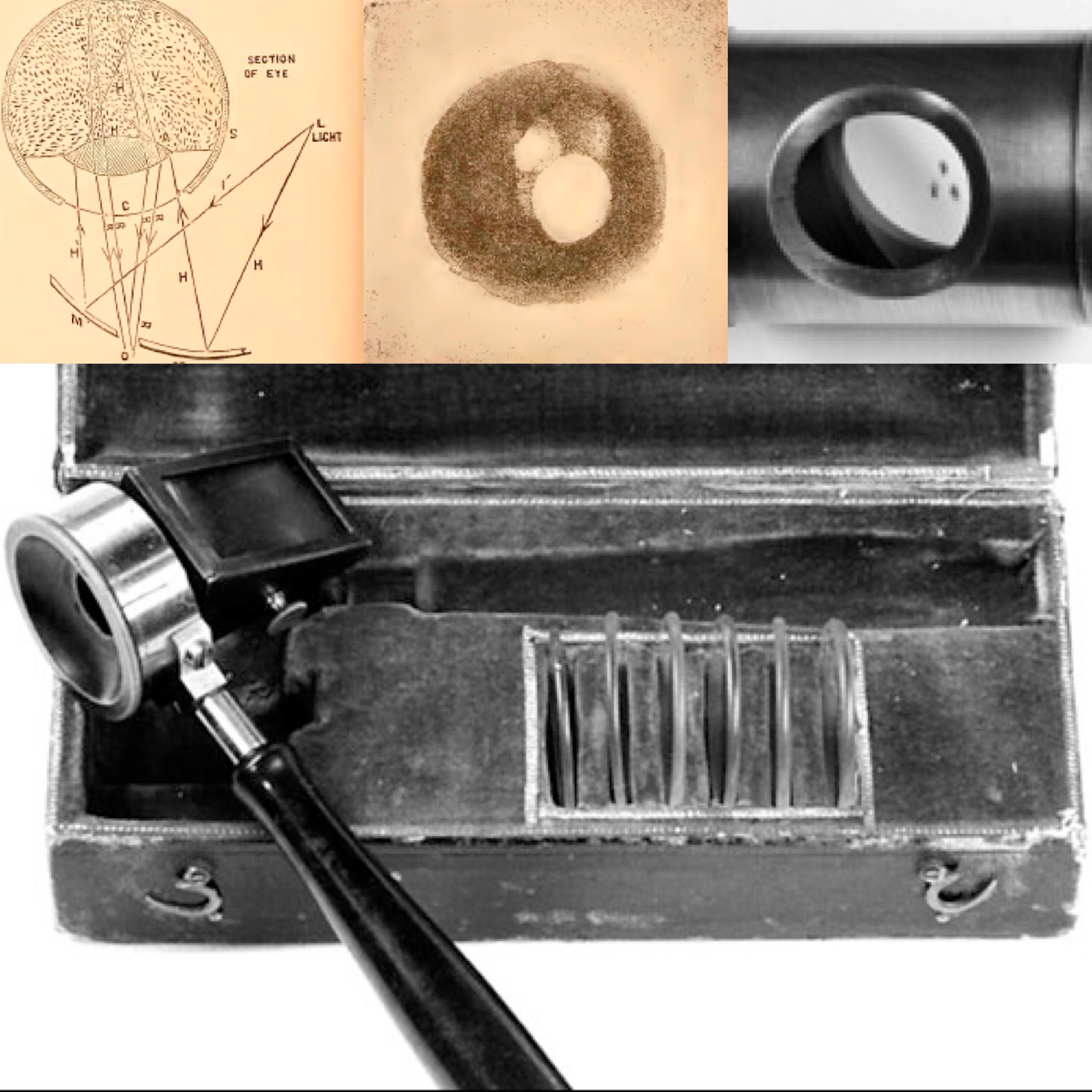 Monocular Indirect Ophthalmoscope