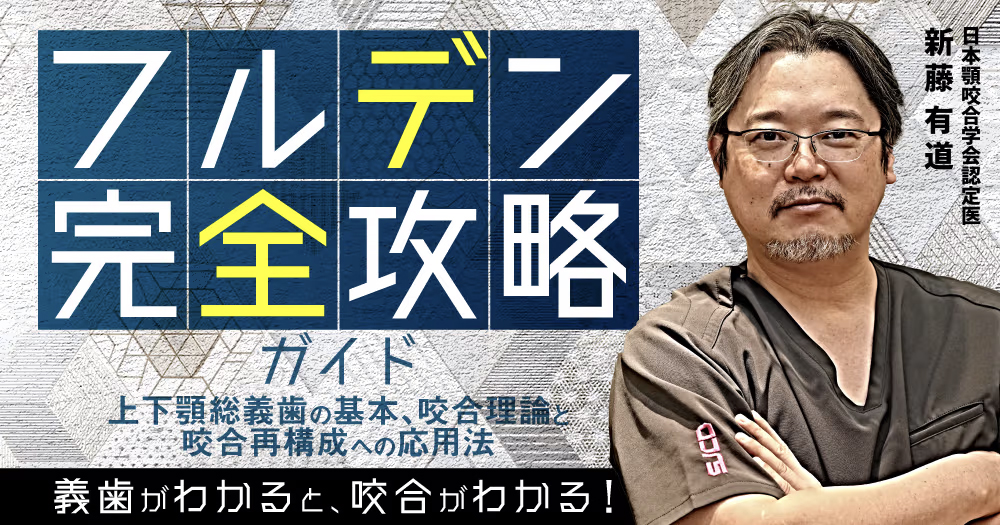 フルデン完全攻略ガイド