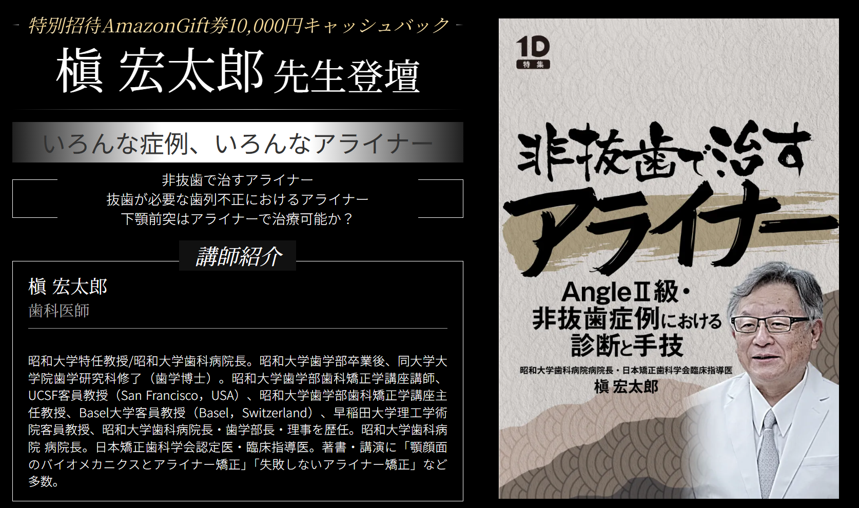 Amazon.co.jp: アライナー矯正のリカバリーテクニック : 槇