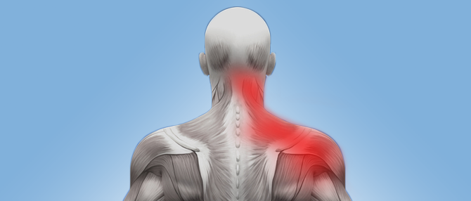 Neck Pain Radiating Down To Shoulder Blade