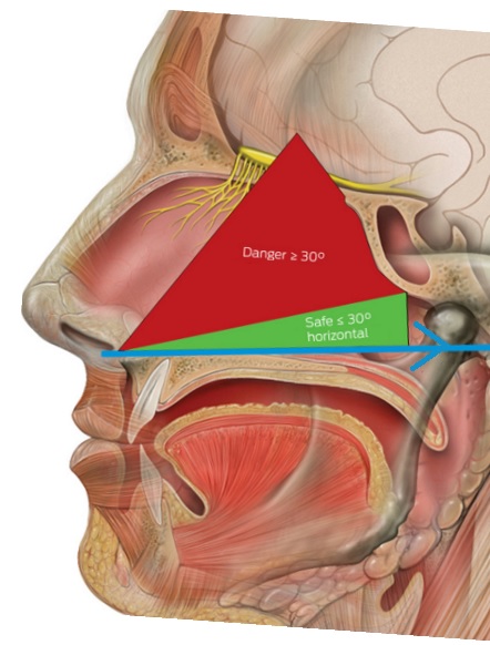 Rouleau de Coton Médical pour Arrêter les Saignements de Nez, 3 Sacs de  Coton de Différentes Tailles pour la Gaze Buccale et les Saignements de Nez,  Petit Rouleau de Coton : : Commerce, Industrie et Science