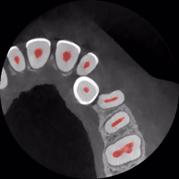 Axial CBCT slice