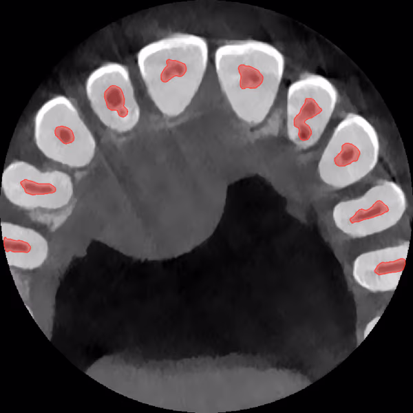 Axial CBCT slice