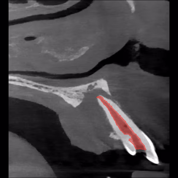 Sagittal scan view