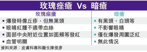 玫瑰痤瘡 vs 暗瘡