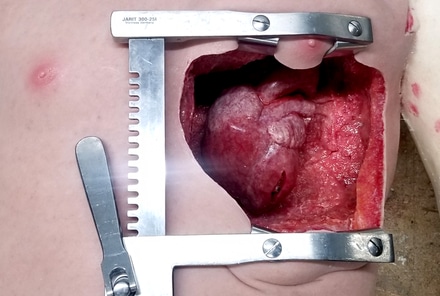 Human Heart