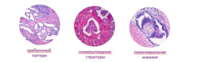 Индекс глиссона что это такое. Смотреть фото Индекс глиссона что это такое. Смотреть картинку Индекс глиссона что это такое. Картинка про Индекс глиссона что это такое. Фото Индекс глиссона что это такое
