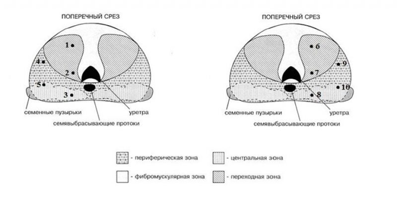 Схема узи предстательной железы