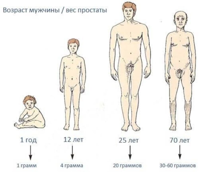 Аденома простаты – симптомы, методы лечения