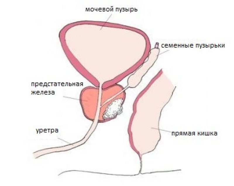 Лечение Рака Фото