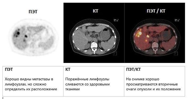 Одно Исследование — Два Метода Визуализации
