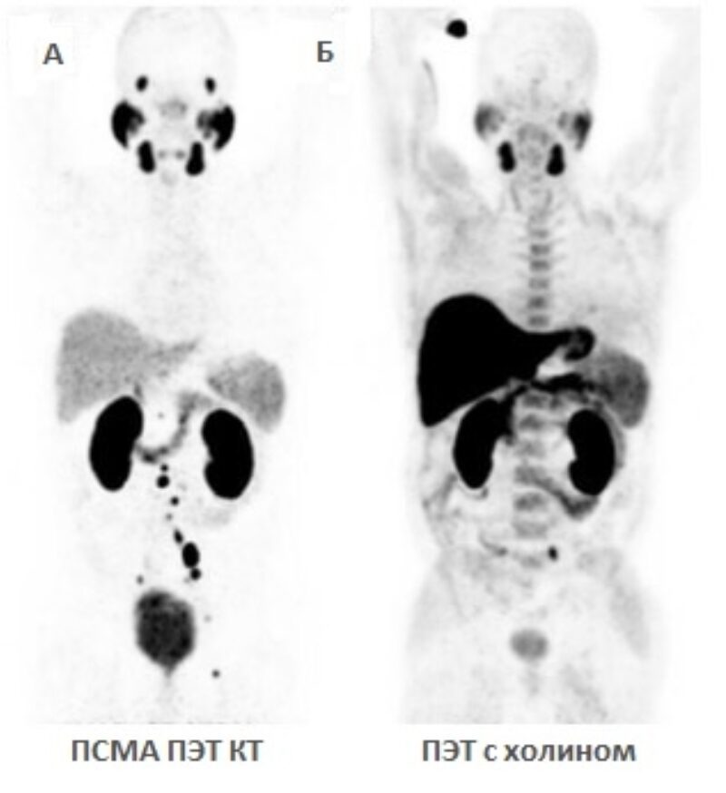 Псма Пэт Кт 2