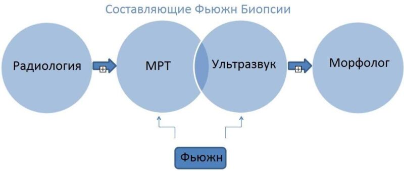 Фьюжн Биопсия Простаты Устройство