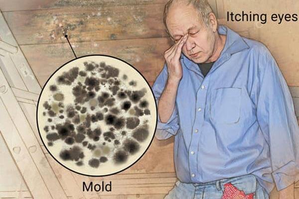 mold symptoms