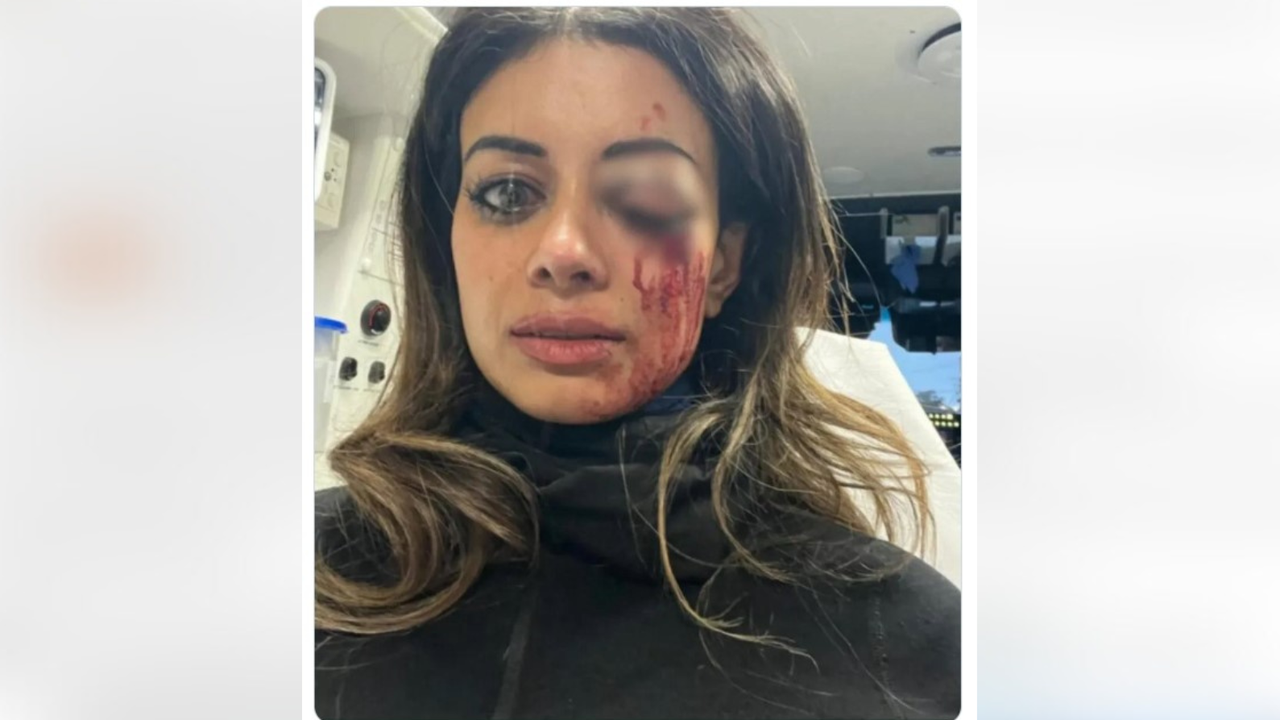 The flipped selfie image showing Ms Thomas's eye injury.