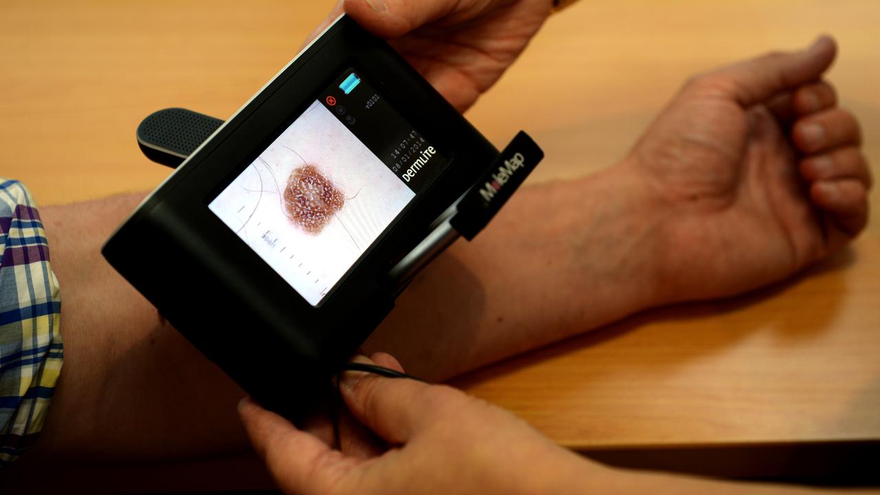 A patient being checked for skin cancers