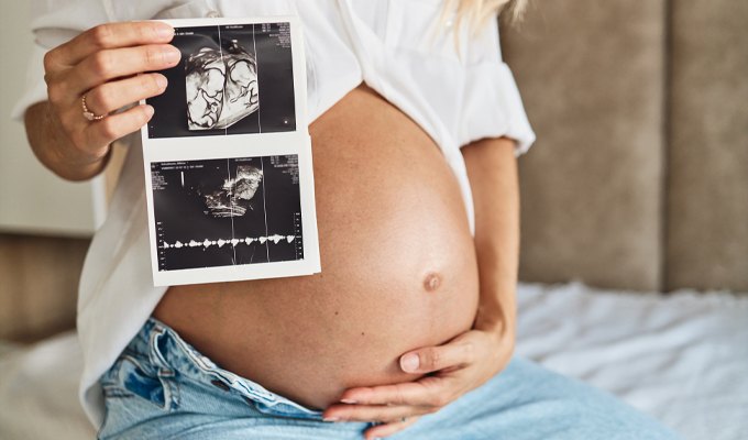 Parto de gêmeos deve ser sempre cesárea? - Obstetrícia - Dr