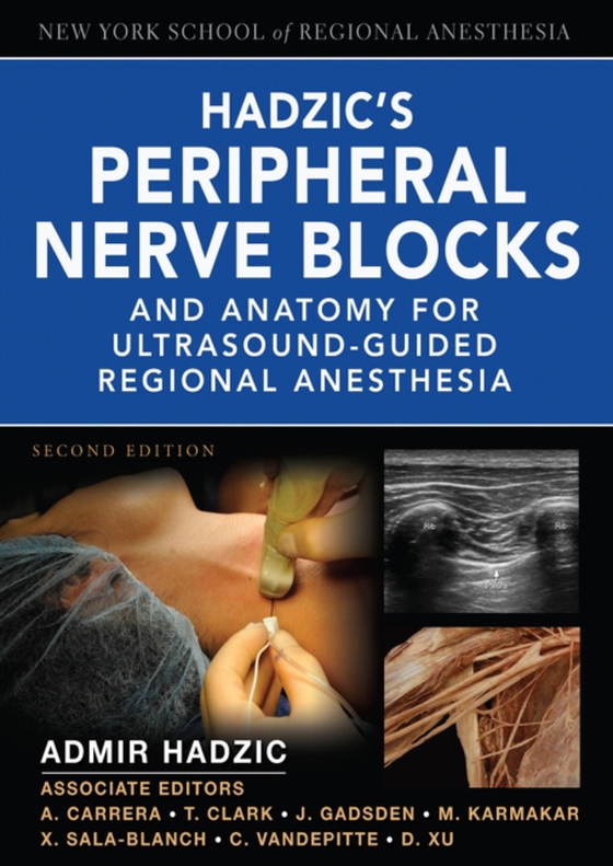 Hadzic's Peripheral Nerve Blocks and Anatomy for Ultrasound-Guided Regional Anesthesia (e-bog) af Hadzic, Admir