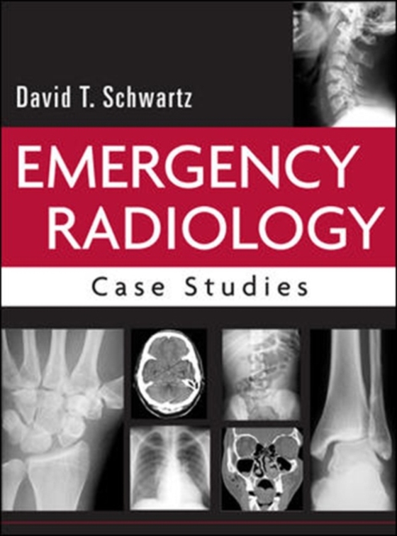 Emergency Radiology: Case Studies (e-bog) af Schwartz, David T.