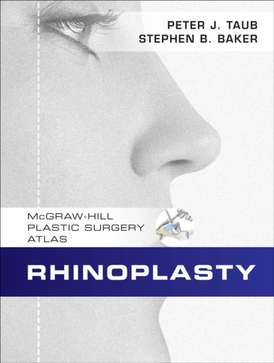 Rhinoplasty (e-bog) af Baker, Stephen