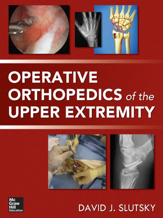 Operative Orthopedics of the Upper Extremity (e-bog) af Slutsky, David