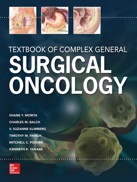 Textbook of General Surgical Oncology (e-bog) af Tanabe, Kenneth K.