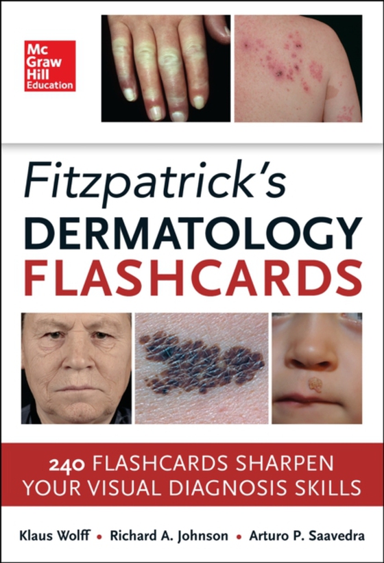 Fitzpatricks Dermatology Flash Cards (e-bog) af Saavedra, Arturo