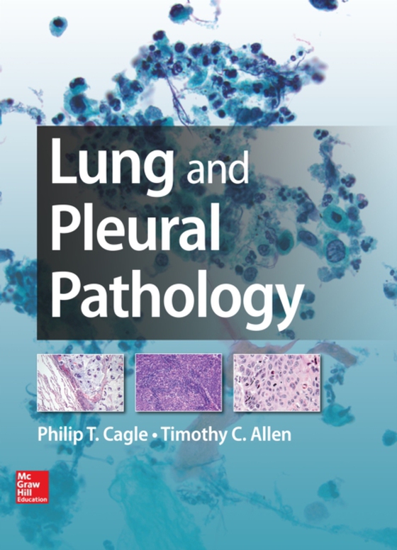 Lung and Pleural Pathology (e-bog) af Allen, Timothy Craig
